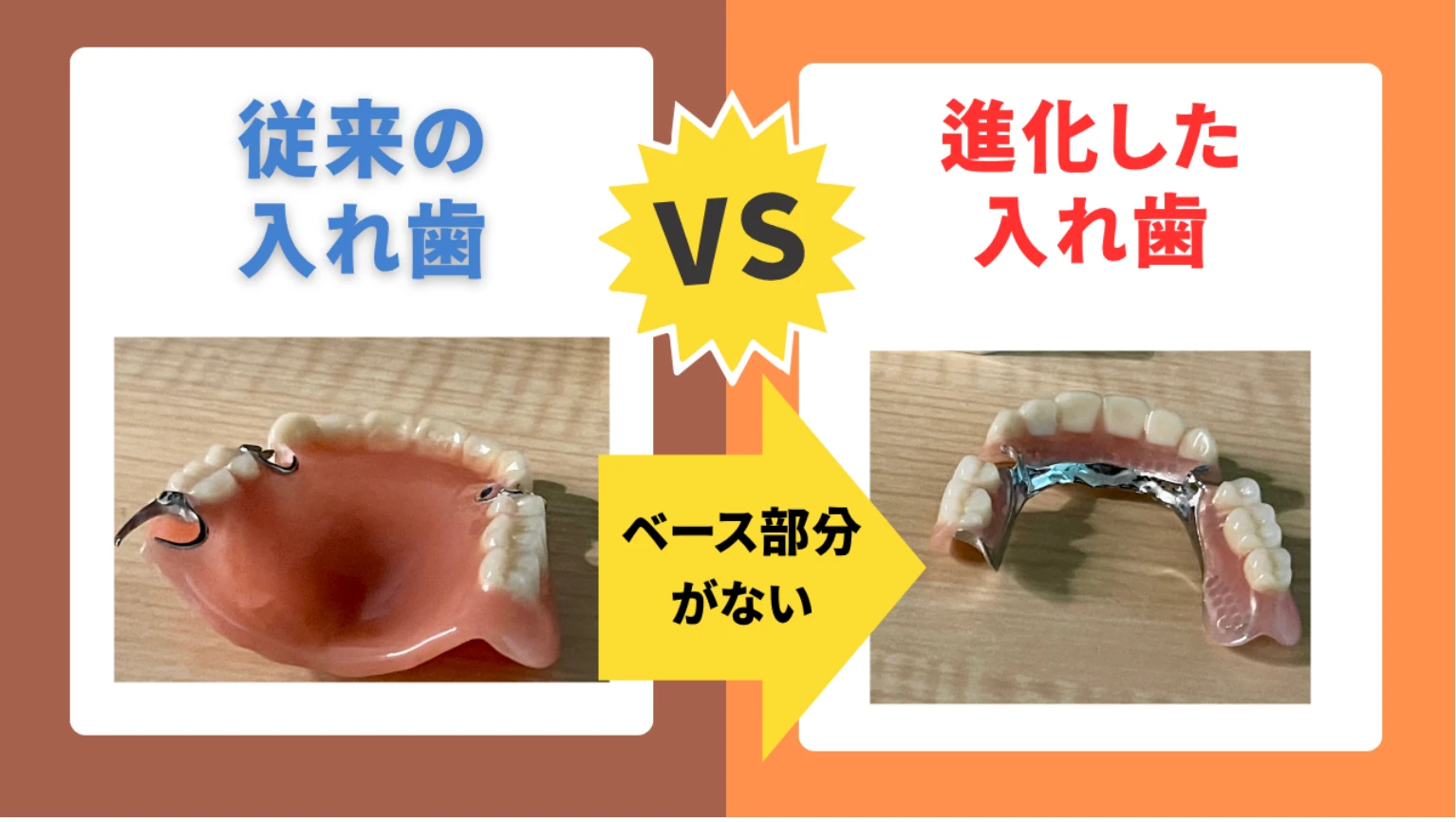 従来の入れ歯と進化した入れ歯の比較画像